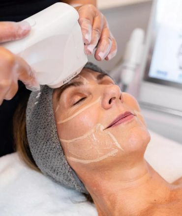 HIFU treatment in noida
